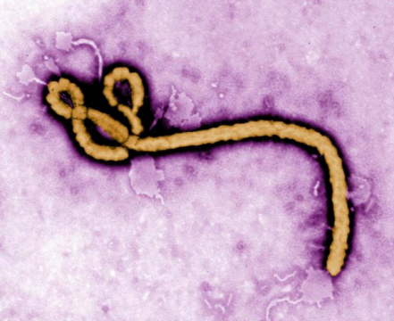 日本将首次引入埃博拉病毒和其他四种致命病毒
